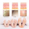 Jaysuing Exfoliating Treatment Spray Deep Clean Exfoliating Dead Skin Whitening And Tender Skin Spray
